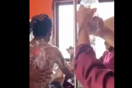 Tolak Cari Rumput Pakan Ternak, Pemuda di Sumbawa NTB Dibakar Ibu Kandung