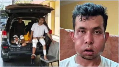 Dua Pelaku Perampokan Disertai Pembunuhan Wanita Lansia di Pekanbaru Ditembak, Muka Bonyok!
