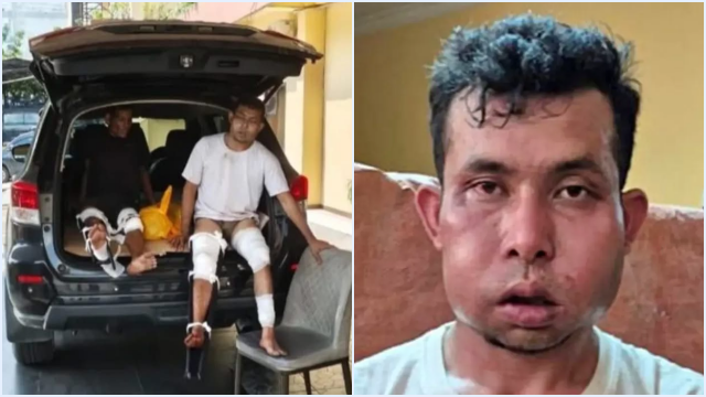 Dua Pelaku Perampokan Disertai Pembunuhan Wanita Lansia di Pekanbaru Ditembak, Muka Bonyok!